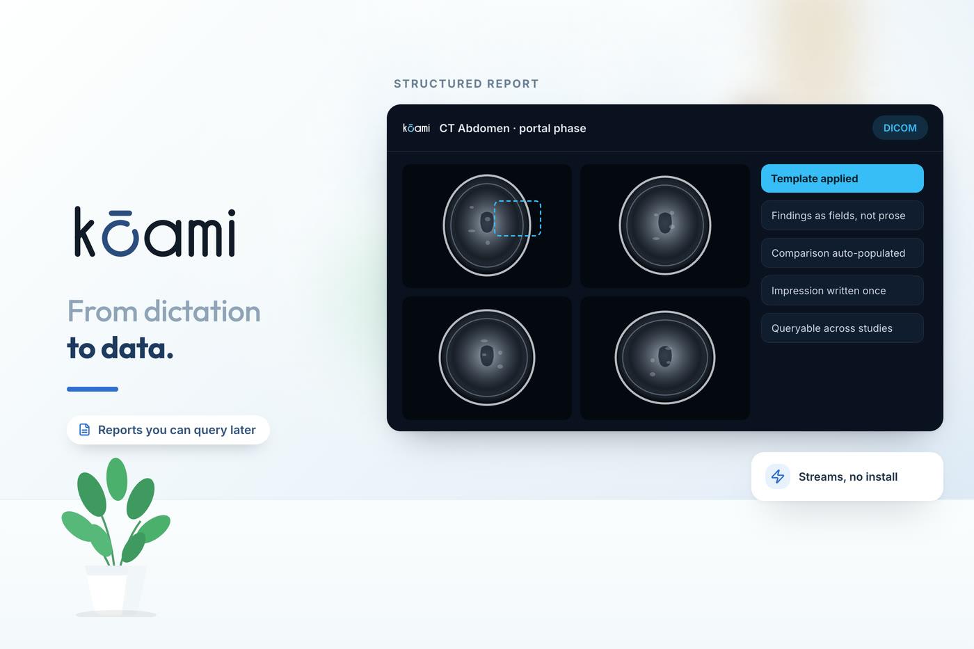 From Dictation to Structured Reports — Radiology | Kōami