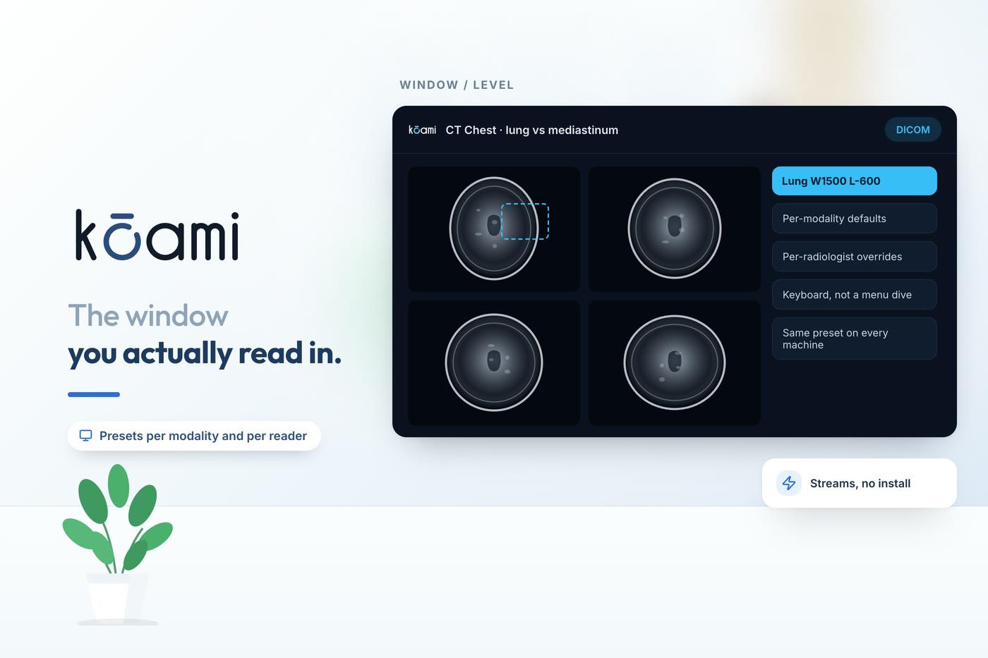Window/Level Presets That Match How You Read — Imaging | Kōami